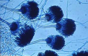 Mycotoxins 